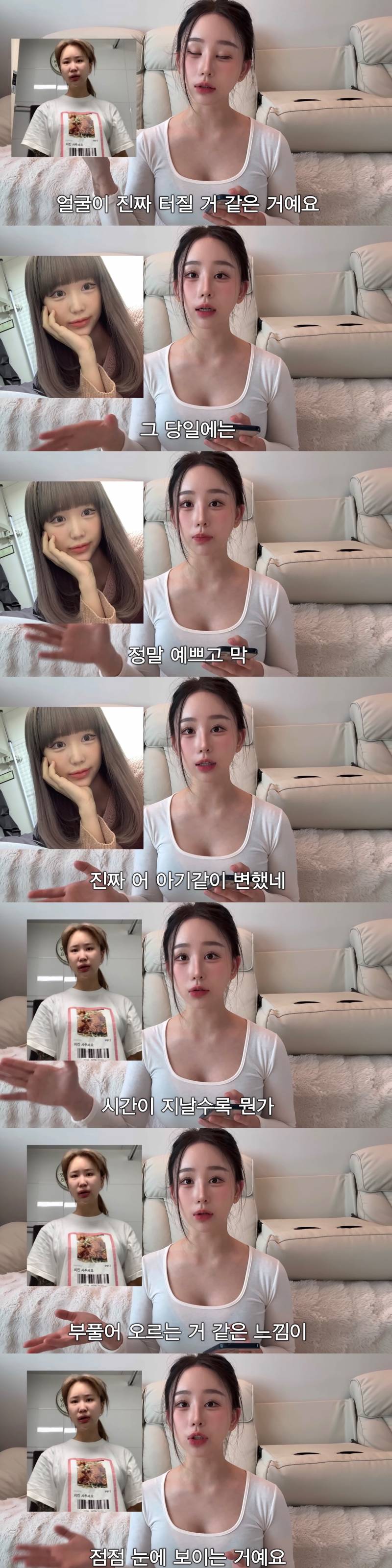 현재 중2때부터 한 수술 다 까발린 조두팔..JPG | 인스티즈