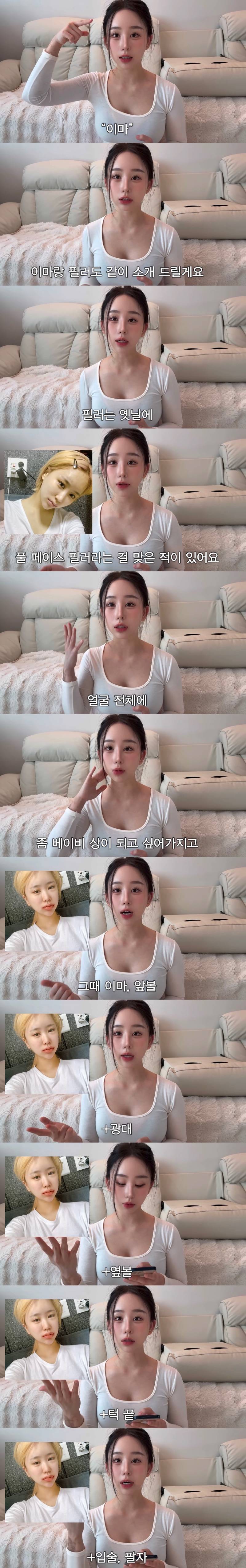 현재 중2때부터 한 수술 다 까발린 조두팔..JPG | 인스티즈