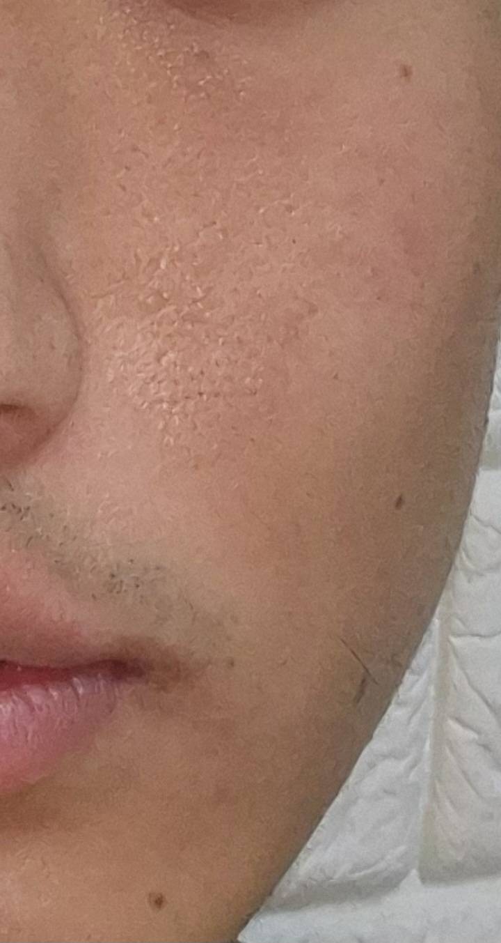[잡담] 내 피부에 이건 뭐야..? | 인스티즈