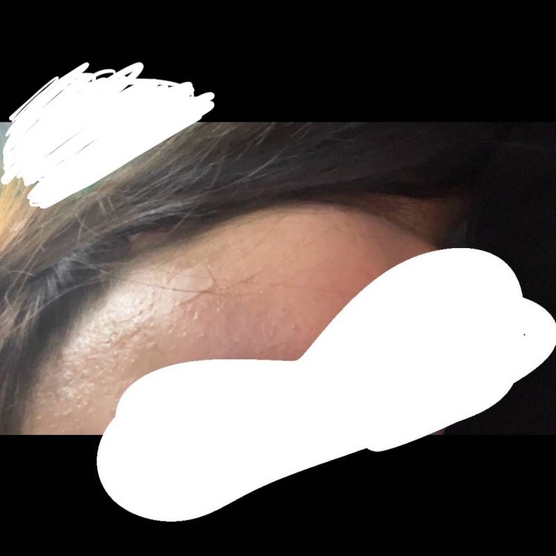 [잡담] 내 피부는 뭘 해야할까...(ㅂㅍ혐 | 인스티즈