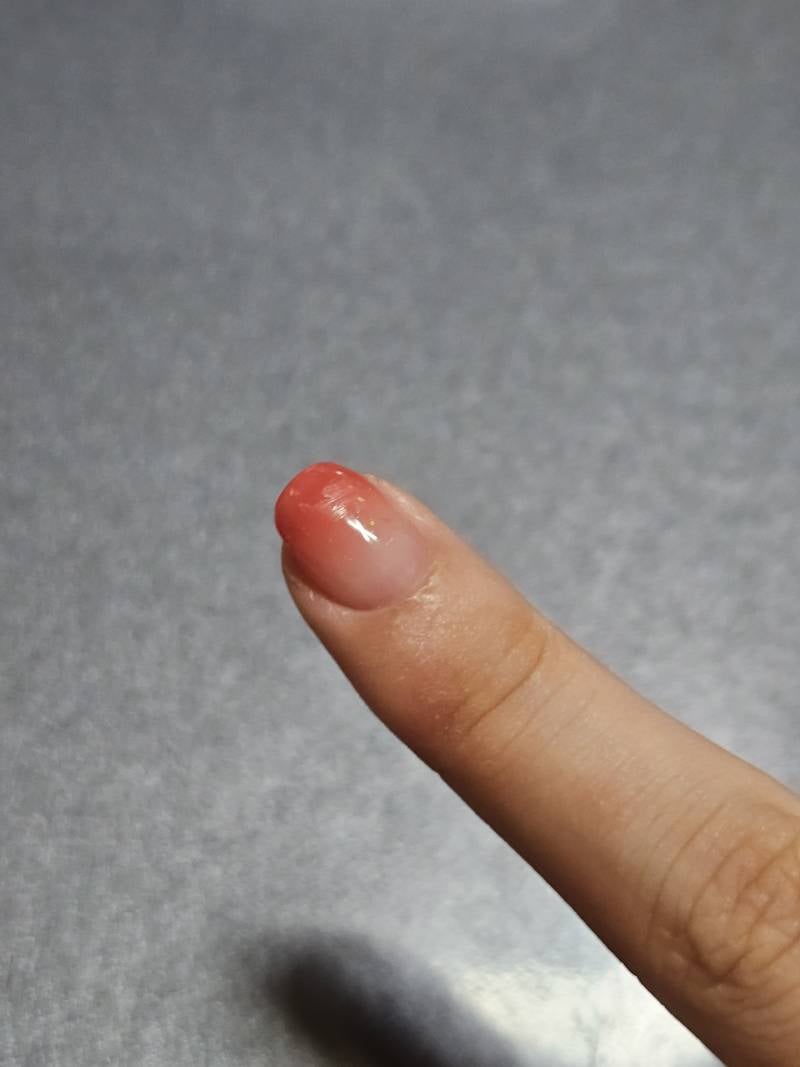 [잡담] 나 젤네일 받았는데 이렇게 벗겨진거 어케 수습해ㅠㅠ | 인스티즈