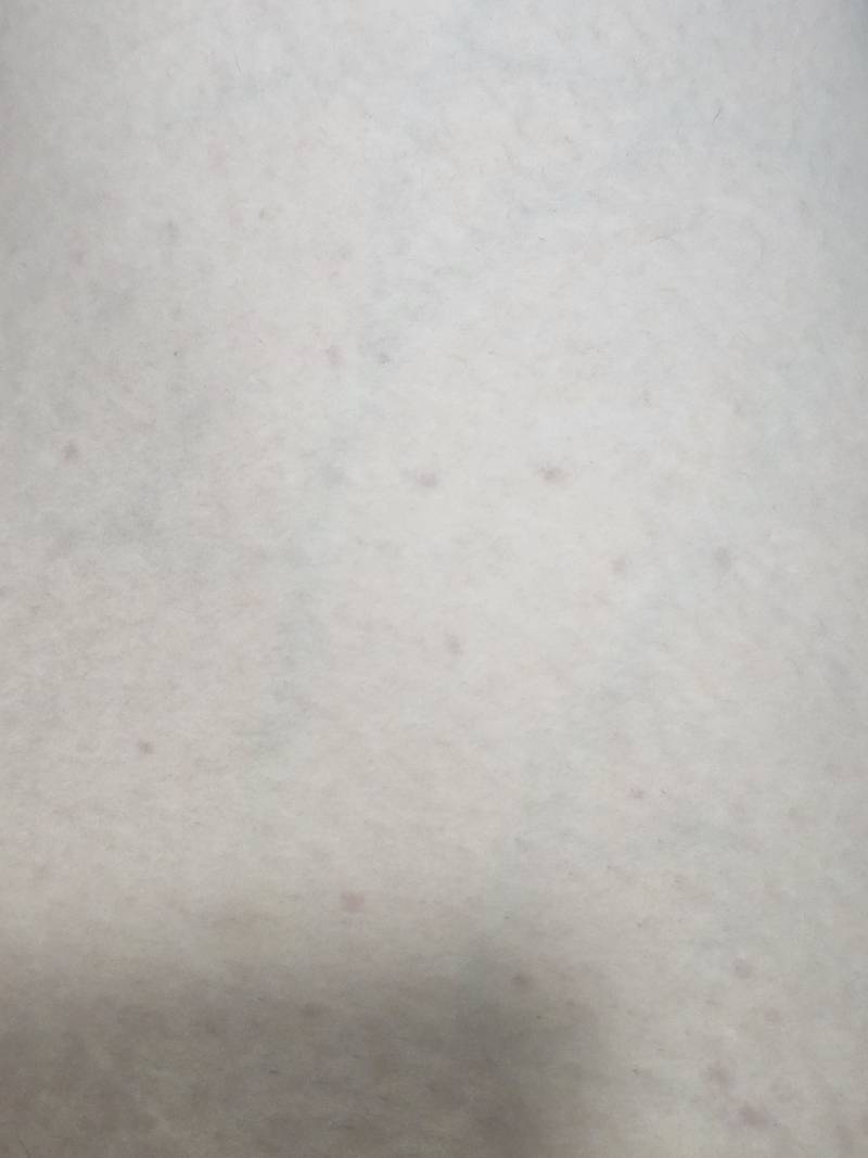 [잡담] 잉 허벅지 왜이러지ㅠ | 인스티즈