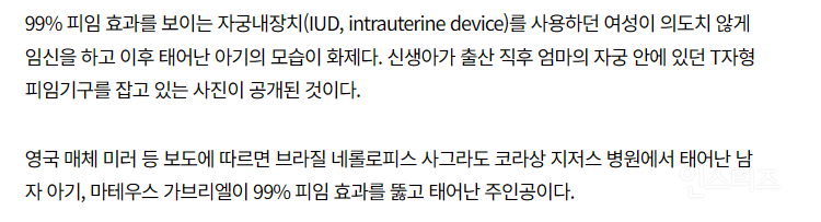 손에 피임장치 쥐고 태어난 아기.jpg | 인스티즈