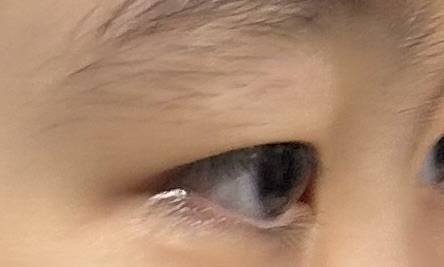 [잡담] 눈두덩이 지방 많은 편이야? | 인스티즈