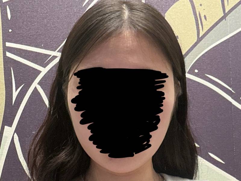[잡담] 앞머리 없어도 괜찮은 얼굴형인가 | 인스티즈