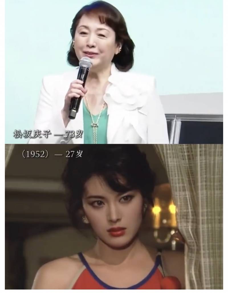 [잡담] 젊음이 좋긴 하구나 | 인스티즈