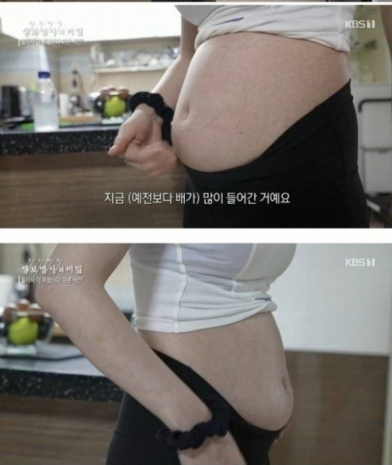 [연애중] 애인 뱃살 어떡해야 함? | 인스티즈