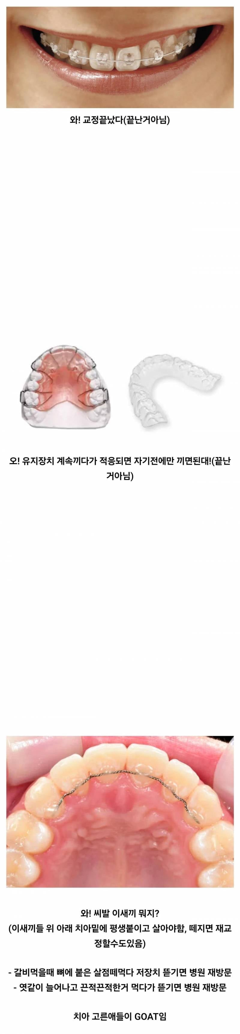 현재 서로 충격받고있는 치아 교정인 인생..JPG | 인스티즈