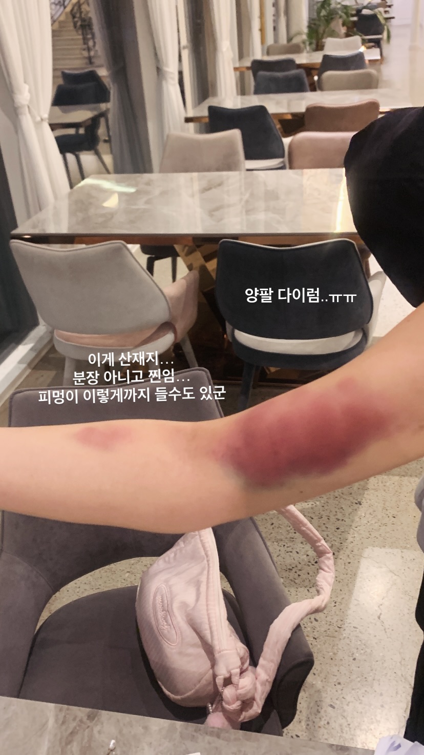 [잡담] 헐... 아무리 촬영이라지만 너무한거 아님...? | 인스티즈
