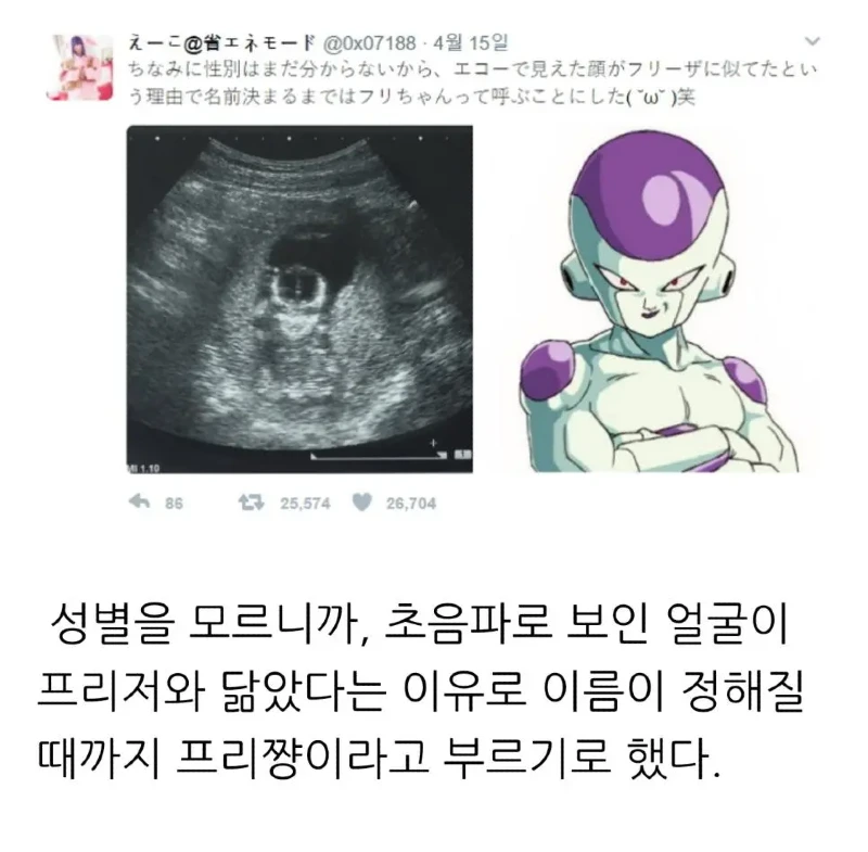 아이 태명이 프리저가 된 이유.jpg | 인스티즈