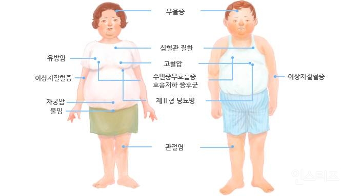 삼성서울병원에서 올린 비만인 사람들이 더 잘걸린다는 병들 | 인스티즈