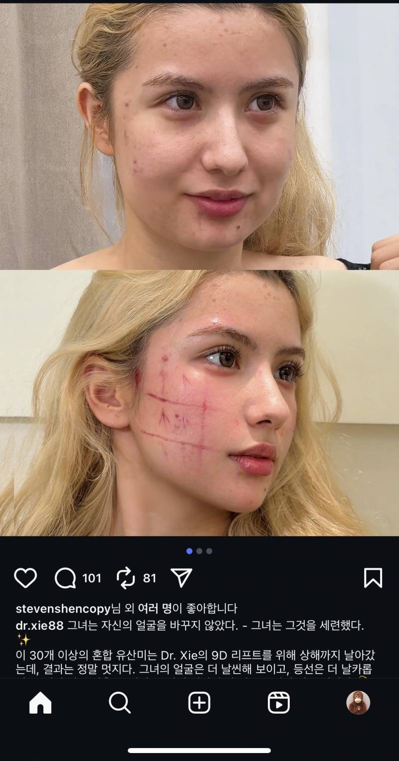 [잡담] 이런거보면 나도 중국 가서 성형 하고 오고싶다 | 인스티즈