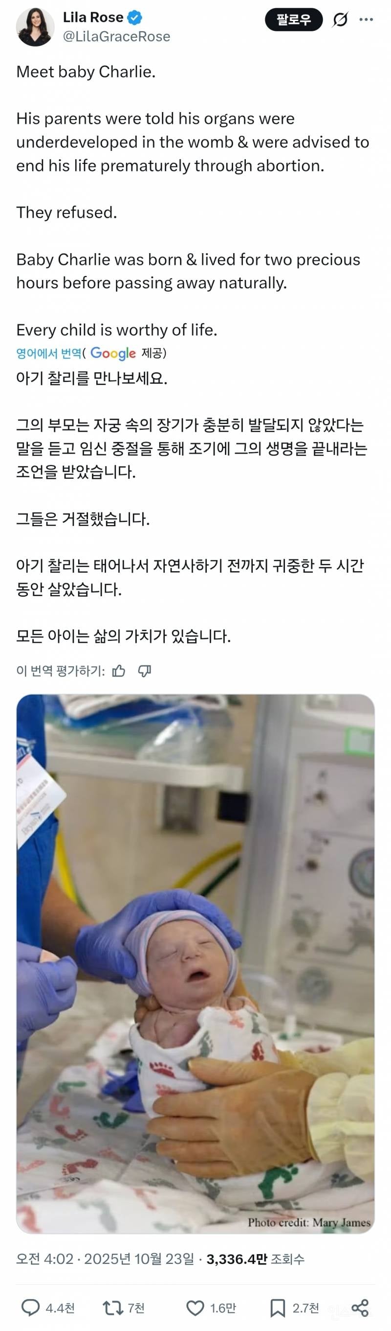 미국에서 난리인 기형아 출산...jpg | 인스티즈