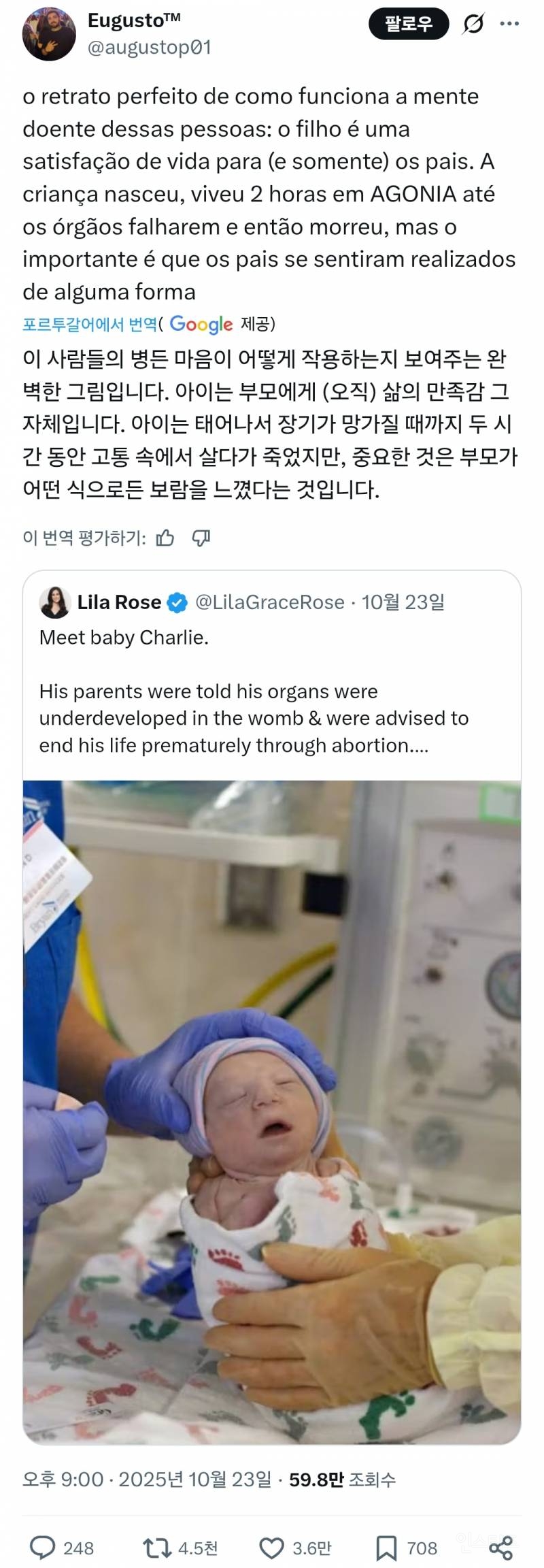 미국에서 난리인 기형아 출산...jpg | 인스티즈
