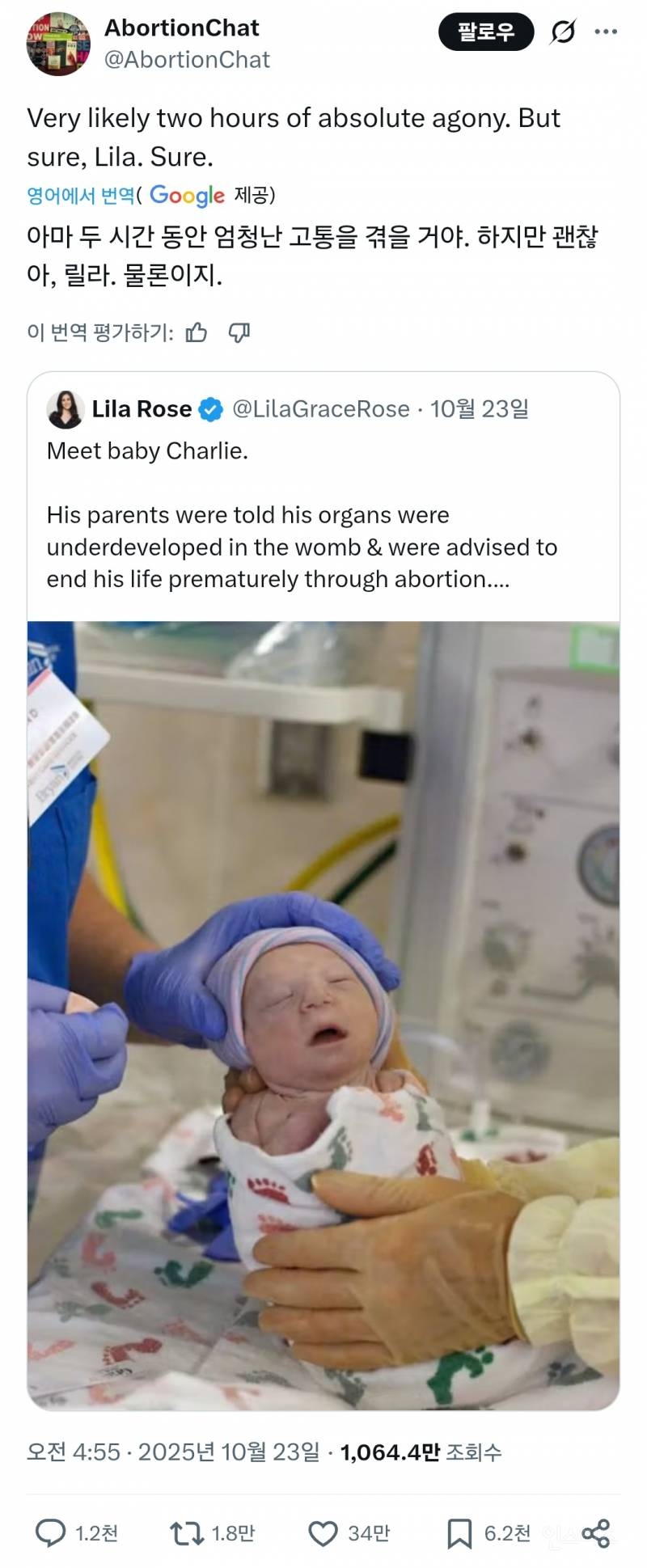 미국에서 난리인 기형아 출산...jpg | 인스티즈
