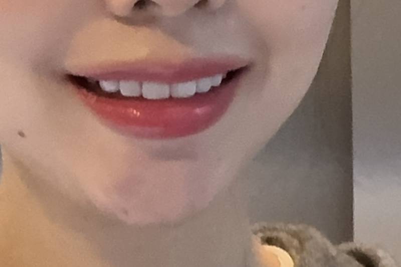 [잡담] 난 라미네이트한거 후회안해 | 인스티즈