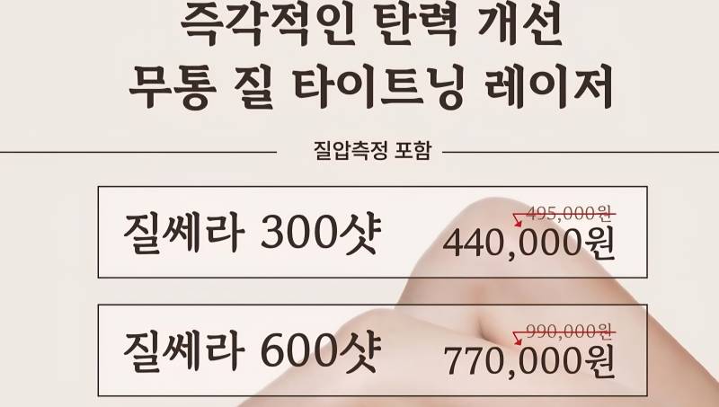 [잡담] ....질쎄라 <이거 하면 미친건가?? | 인스티즈