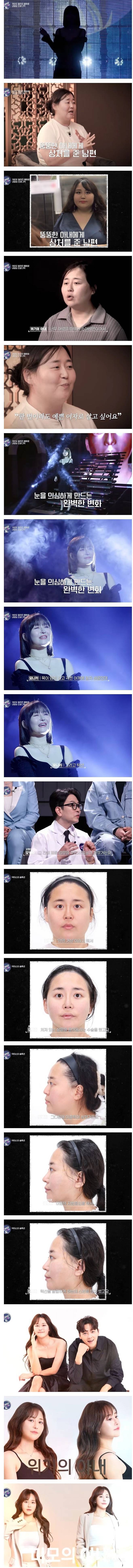 100일 만에 달라진 얼굴로 나타난 아내 | 인스티즈