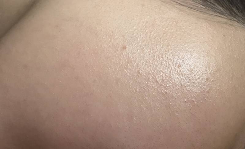 [잡담] 피부에 이거 머지? ㅎㅇㅈㅇ | 인스티즈
