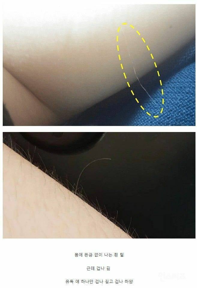 몸에 나는 털 중 정체를 알 수 없는 털 | 인스티즈