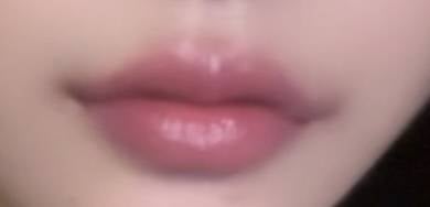 [잡담] 입술필러 3일차인데 | 인스티즈