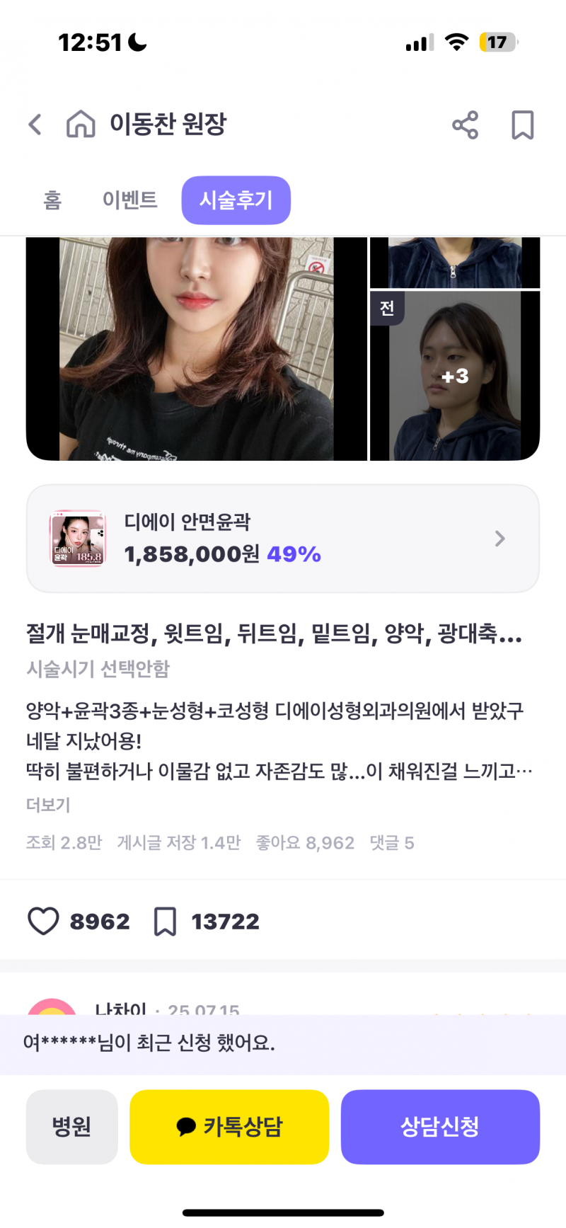 [잡담] 와 여자 성형전후 진짜 레전드다… | 인스티즈