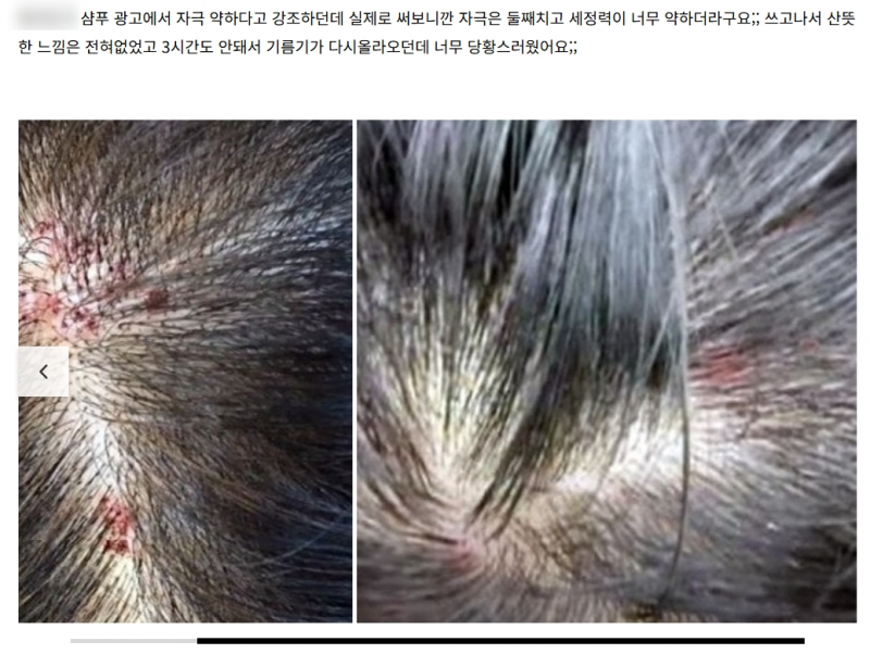 [잡담] 나 충격적인 역바이럴을 목격했어... | 인스티즈