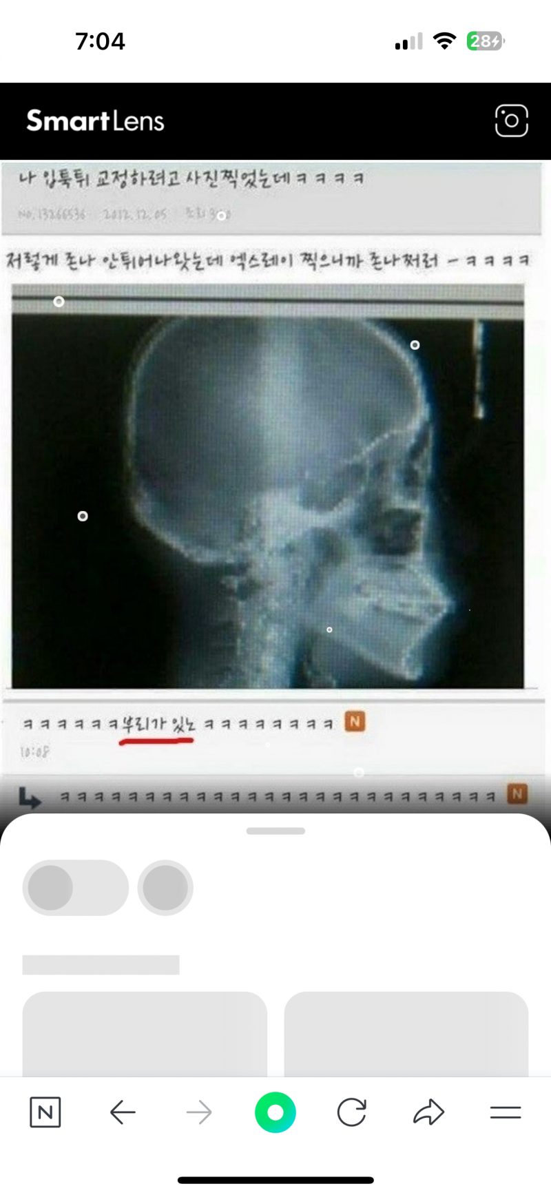 [잡담] 입술필러맞고 도라에몽 비실이 됨 | 인스티즈