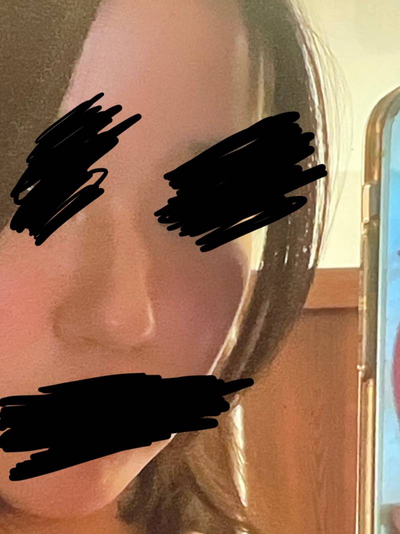 [잡담] 나 코 성형 대체 뭐해야하냐… | 인스티즈