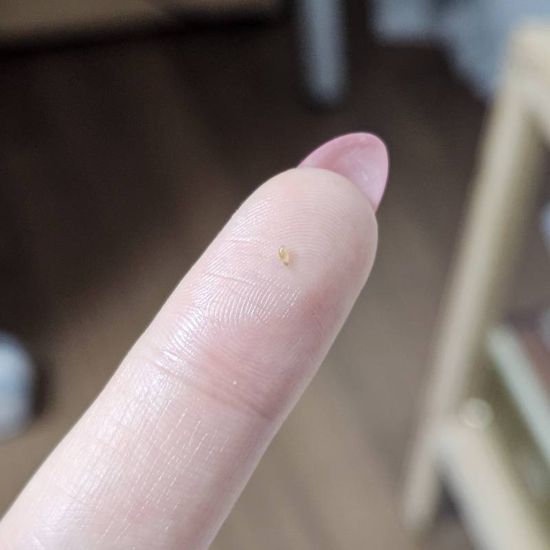 [잡담] 나 딱딱 피지 뺐어 ㅎㅎㅎㅎ ㅎㅇㅈㅇ | 인스티즈