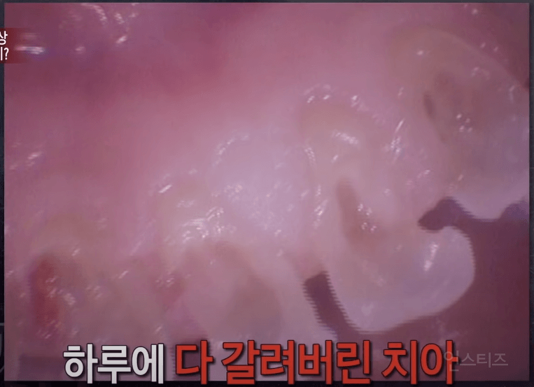 분노주의)이빨 갈아버린 싸이코패스 치과의사 | 인스티즈