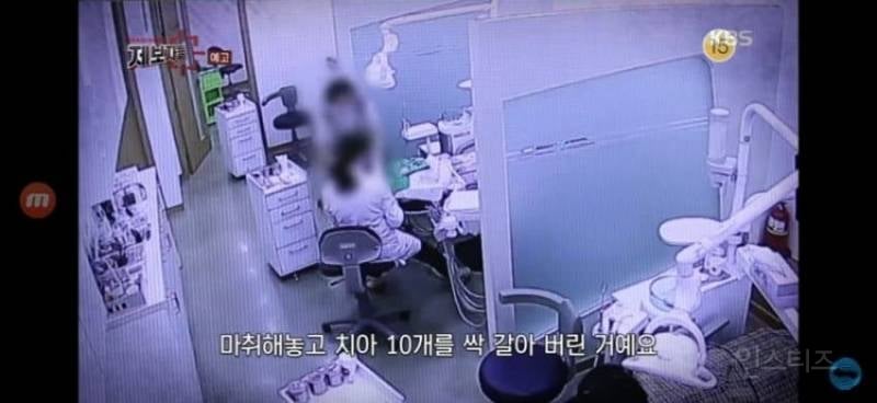 분노주의)이빨 갈아버린 싸이코패스 치과의사 | 인스티즈