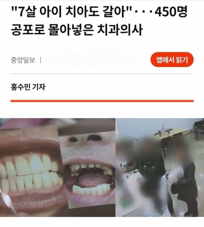 분노주의)이빨 갈아버린 싸이코패스 치과의사 | 인스티즈
