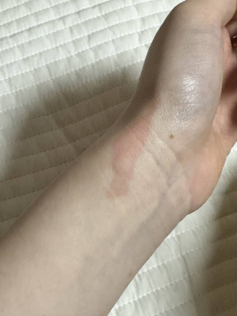 [잡담] 이거 핫팩에 대인건가? | 인스티즈