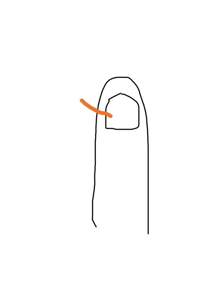 [잡담] 손 이런 상태인데 네일해도 되려나 | 인스티즈