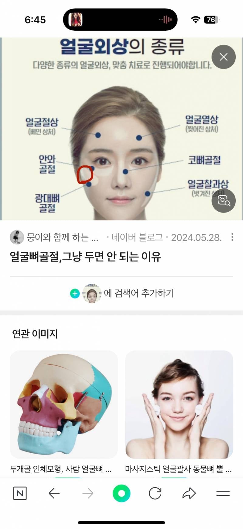 [잡담] 얼굴 여기 뼈가 너무 아픈데 왜일까... | 인스티즈