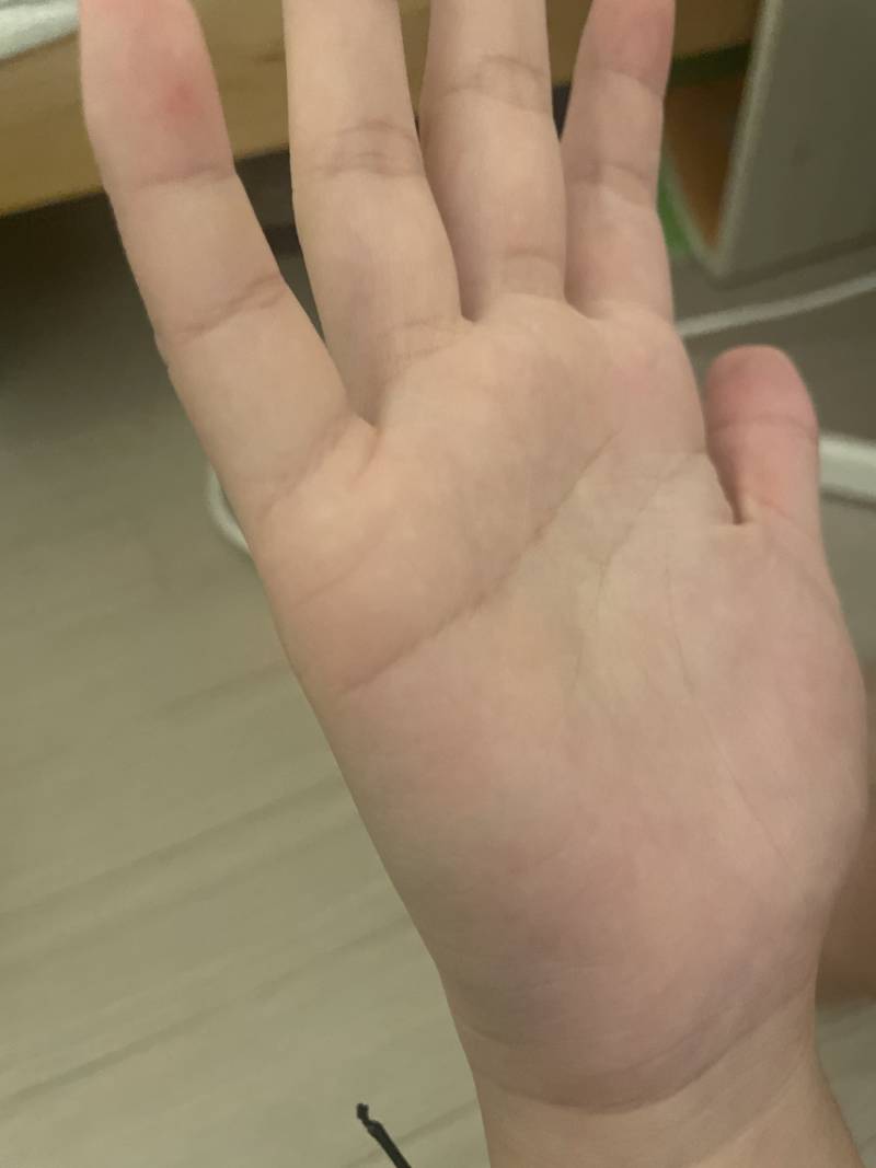 [잡담] 손날 근육이 아픈데 왜구러지 | 인스티즈