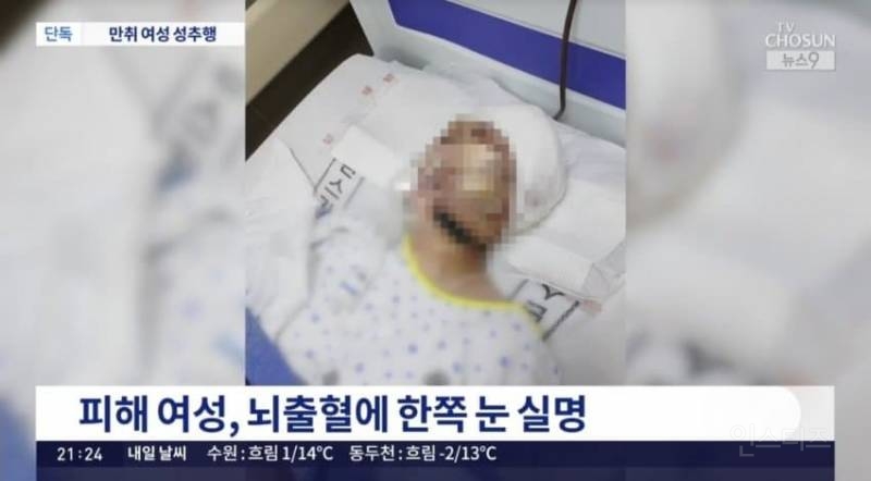 만취여성 성추행 뒤 길거리 방치해 '실명'…잡고보니 유명 연예 기획사 임원 | 인스티즈