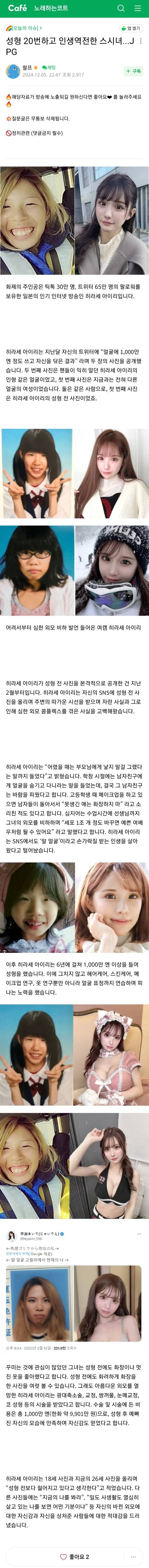 성형 20번하고 인생역전한 일본여자...JPG | 인스티즈