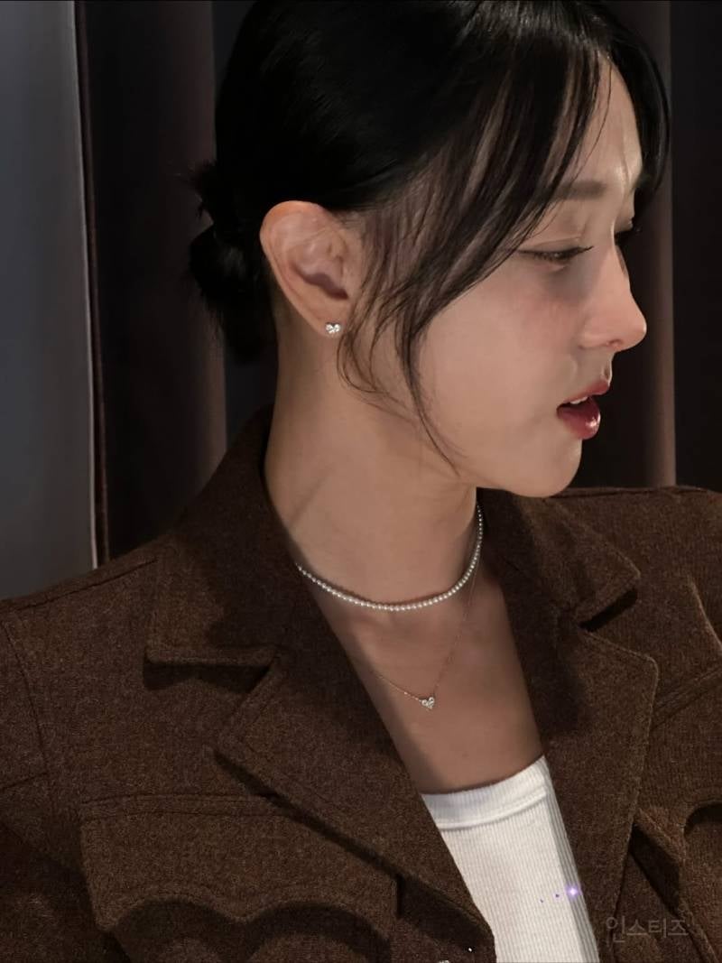 인중축소 성형수술 고백한 이지혜.jpg | 인스티즈