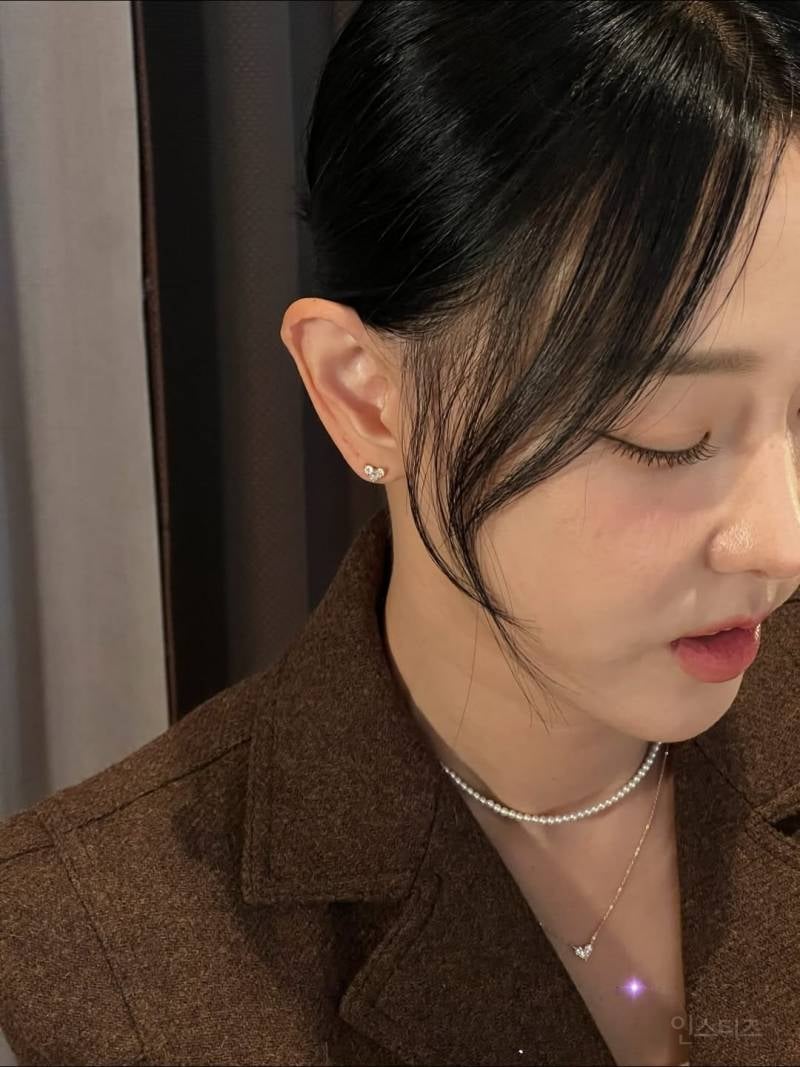 인중축소 성형수술 고백한 이지혜.jpg | 인스티즈