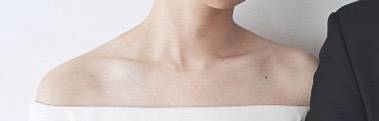 [잡담] 나 승모근 있는 편인지 봐주라 | 인스티즈