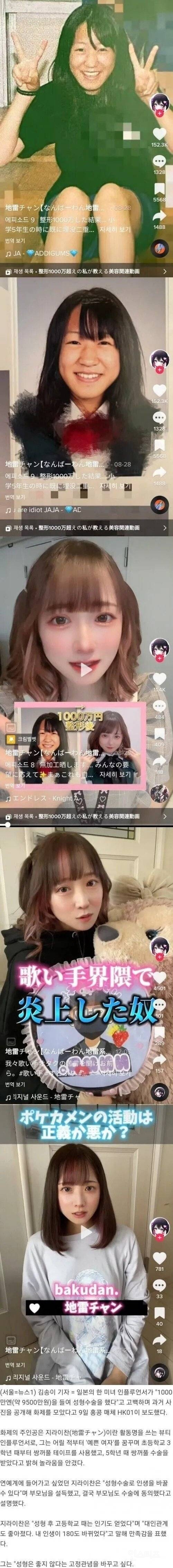 성형수술에 1억 쓴 일본 인플루언서 | 인스티즈