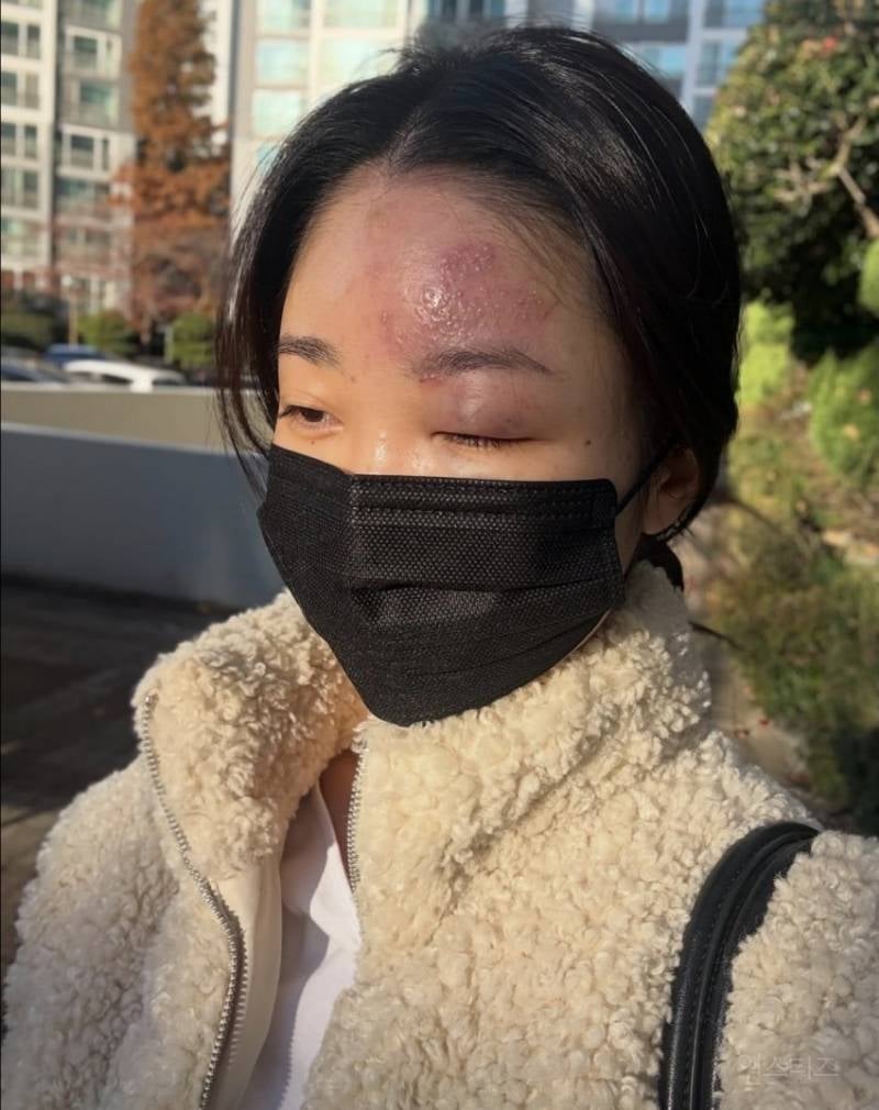 사진주의)현재 스레드에서 난리난 역대급 의료사고.jpg | 인스티즈