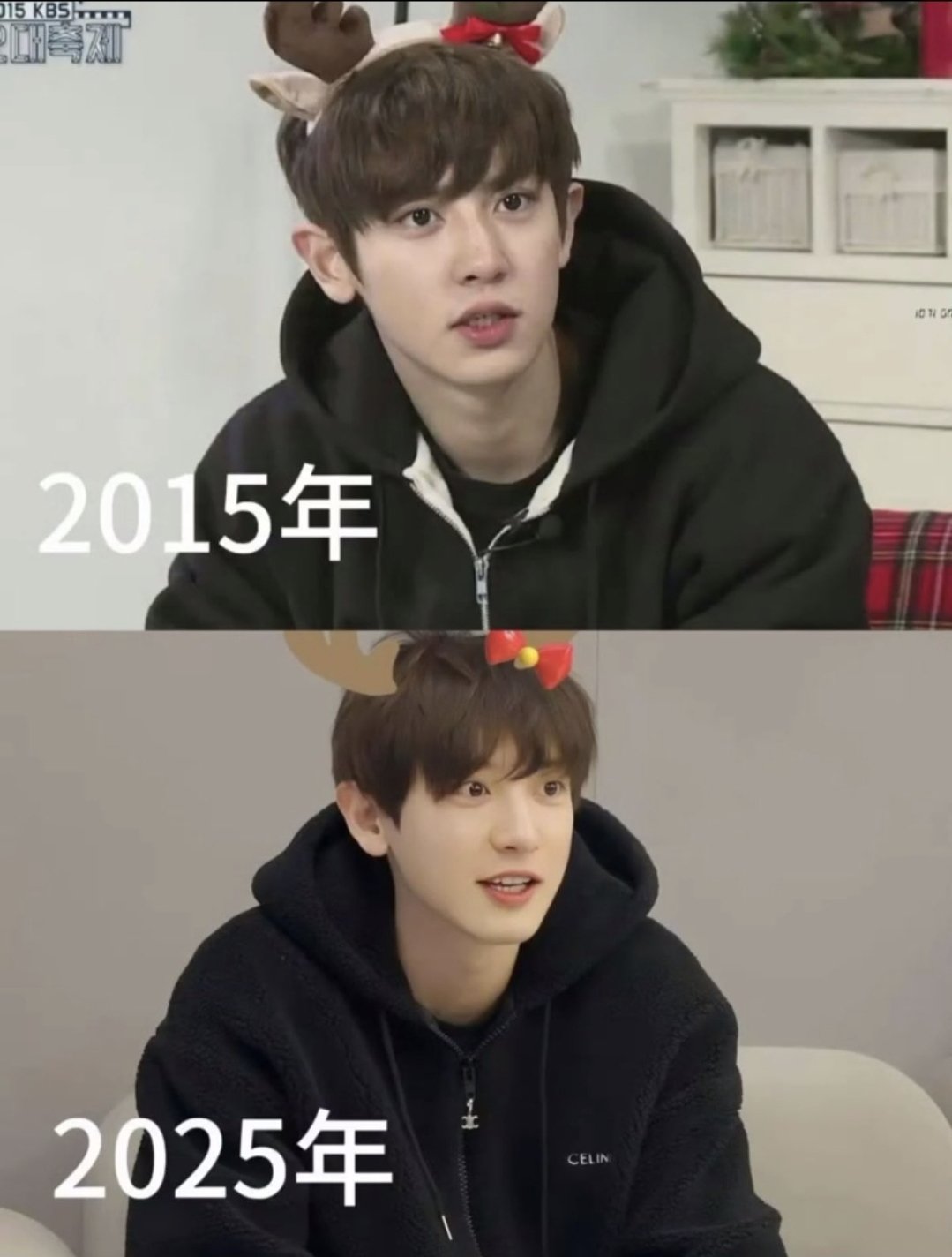[잡담] 찬열오빠 얼굴관리 어케함 | 인스티즈