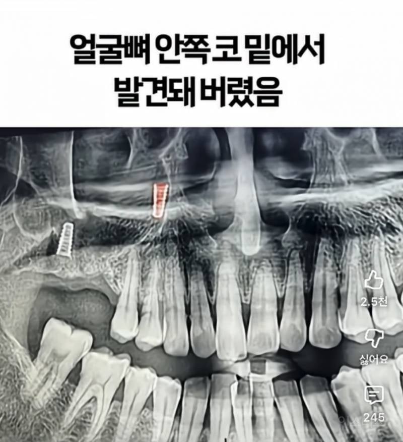 기괴한 리뷰로 가득한 서울의 어느 치과 | 인스티즈