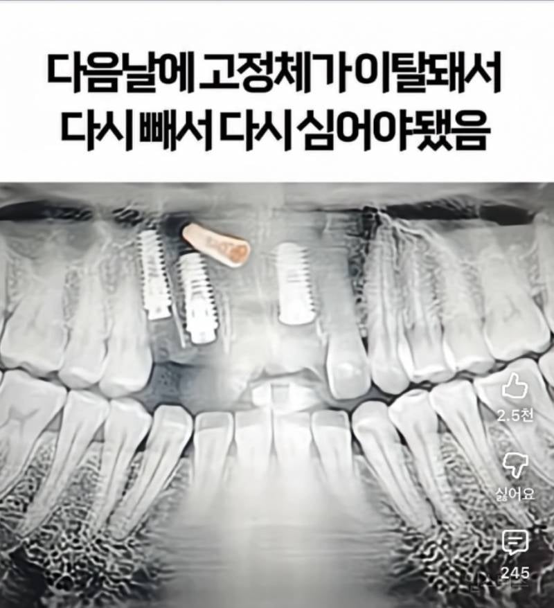 기괴한 리뷰로 가득한 서울의 어느 치과 | 인스티즈