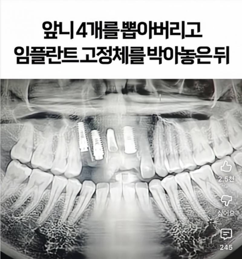 기괴한 리뷰로 가득한 서울의 어느 치과 | 인스티즈