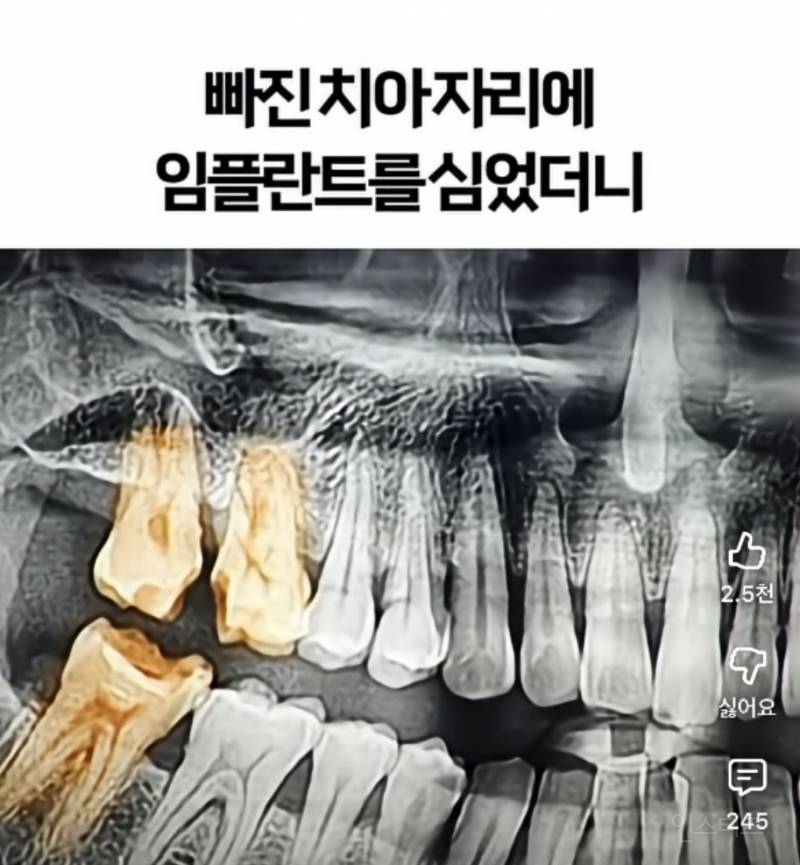 기괴한 리뷰로 가득한 서울의 어느 치과 | 인스티즈