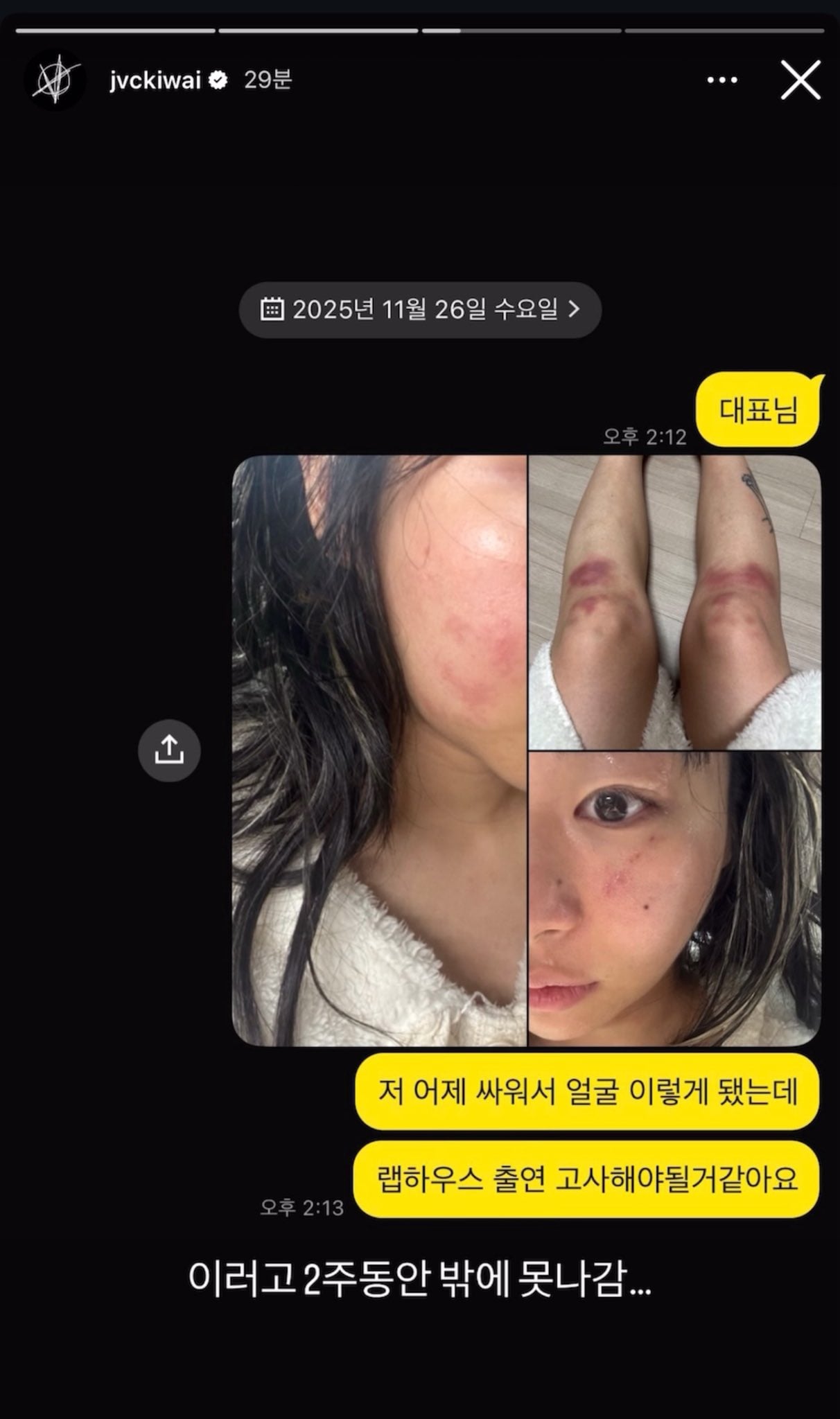 [잡담] 래퍼 재키와이 데이트폭력 당했나봄 | 인스티즈